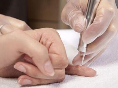 Provođenje laserske terapije