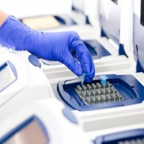 PCR analiza